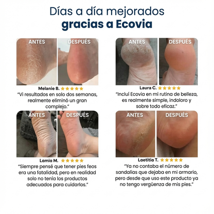 Mascarilla exfoliante mágica para pies Ecovia